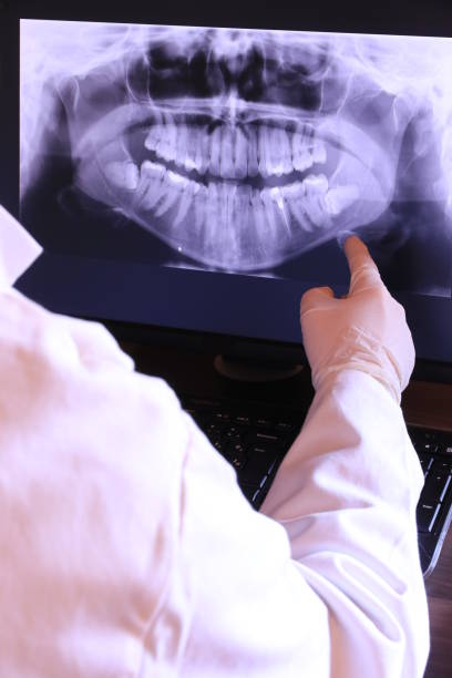 Best Emergency Care for Gum Disease in Sykesville, MD